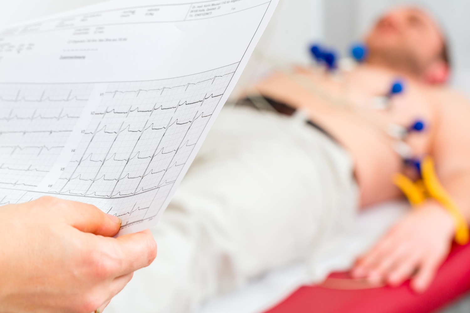 EKG